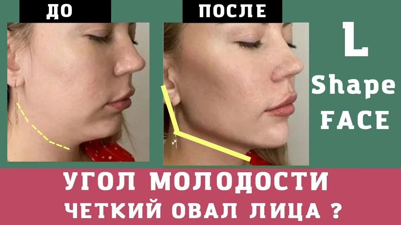 Угол молодости. Угол молодости на лице упражнения. четкий угол молодости. молодость без уколов упражнения для угла молодости. не четкий угол молодости.