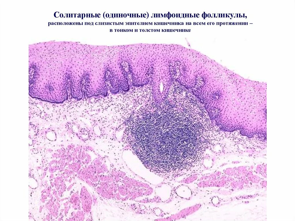 Ткани толстой кишки. Солитарный фолликул гистология. Лимфоидные фолликулы гистология. Эпителий Толстого кишечника гистология. Солитарные фолликулы кишечника.