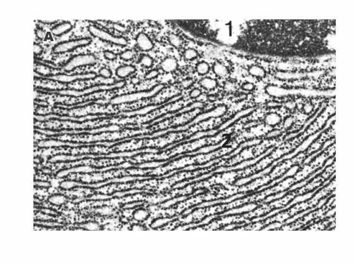 Эндоплазматическая сеть микрофотография. Эндоплазматическая сеть микрофотография. Комплекс гольджи микрофотография. Шероховатая эпс микрофотография. Гладкая эпс микрофотография.