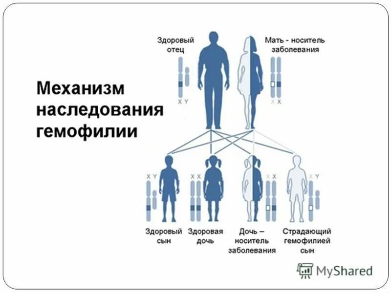 Гемофилия типа а. Наследование признаков гемофилии. гемофилия тип наследования. гемофилия генетика тип наследования. механизм наследования гемофилии.