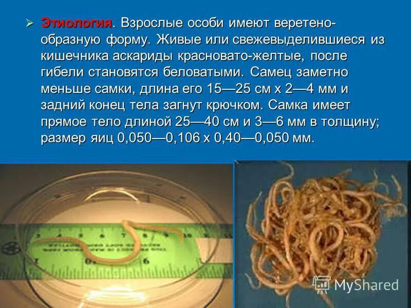 Какой вред могут причинять взрослые аскариды