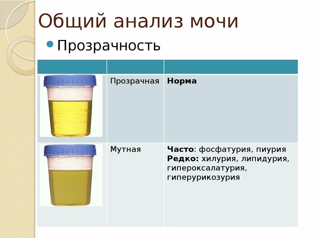 Сколько грамм мочи