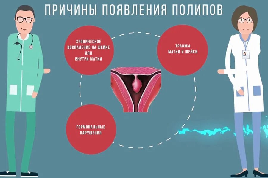 Может стать причиной появления. Полип цервикального канала. Удаление полипа цервикального канала. Причины появления полипа в матке. Причины появления полипов.