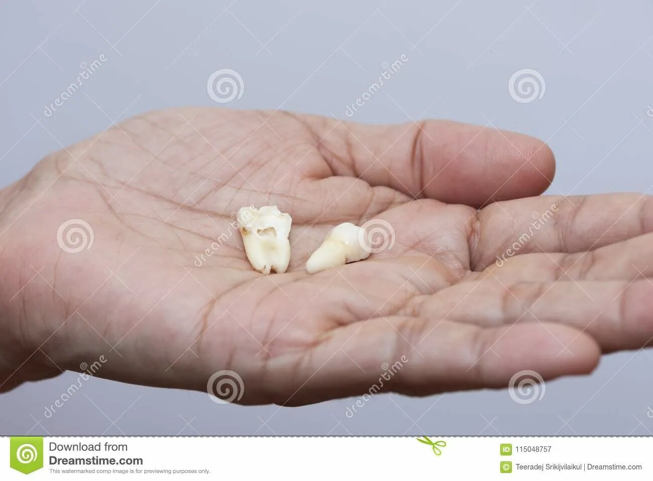 Сон вытаскивать зубы руками. Сон вытаскивать зубы руками. Сонник во сне приснилось выпал зуб. Сонник выпадение зубов без крови. Зуб мудрости стволовые клетки.