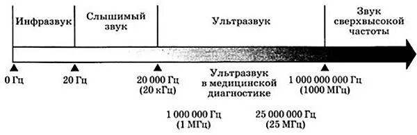 Диапазон частоты ультразвуковых волн. Частоты инфразвук ультразвук. Диапазон частоты звуковых волн инфразвук ультразвук. Диапазон звуковых волн для человека. Инфразвук в гц