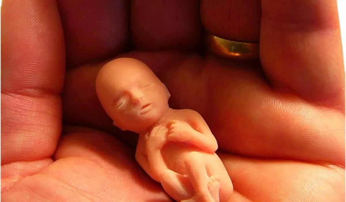 12 неделя ощущения. Эмбрион человека 10 недель беременности. Человеческий эмбрион на 12 неделе беременности. Эмбрион на 12 неделе беременности выкидыш. Эмбрион 9-10 недель беременности.