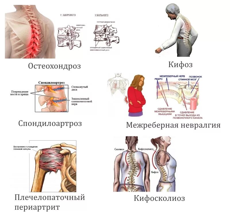 Немеет поясница