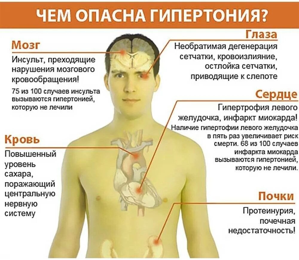 Чем опасно повышение артериального давления. Gepertoniya. Артериальная гипертензия симптомы. Гипертоническая болезнь симптомы.