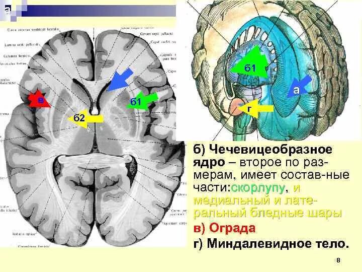 Изменение в базальных отделах. Чечевицеобразное ядро полосатое тело. Подкорковые ядра (чечевицеобразное, скорлупа, бледный шар). Чечевицеобразное ядро мозга анатомия. Бледный шар чечевицеобразного ядра.