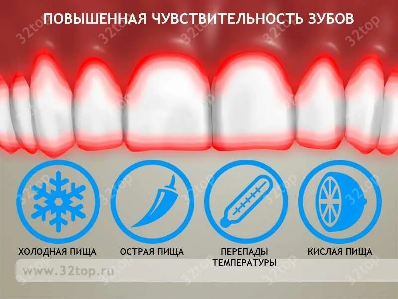 Зуб дает температуру. Чувствительность зубов. Повышенной чувствительности зубов. Повышенная чувствительность зуба.
