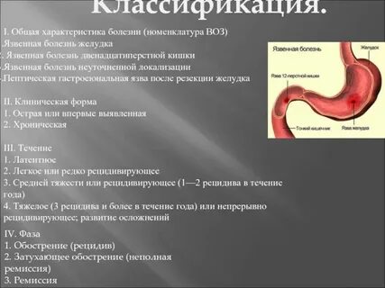 Признаки язвы желудка у мужчин
