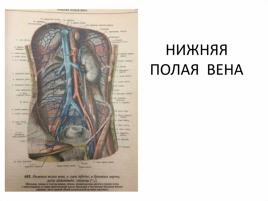 Нижняя полая вена образуется. Нижняя полая Вена кровоснабжает. Нижняя полая Вена топография. Нижняя полая Вена и ее притоки. Нижняя полая Вена и ее ветви.