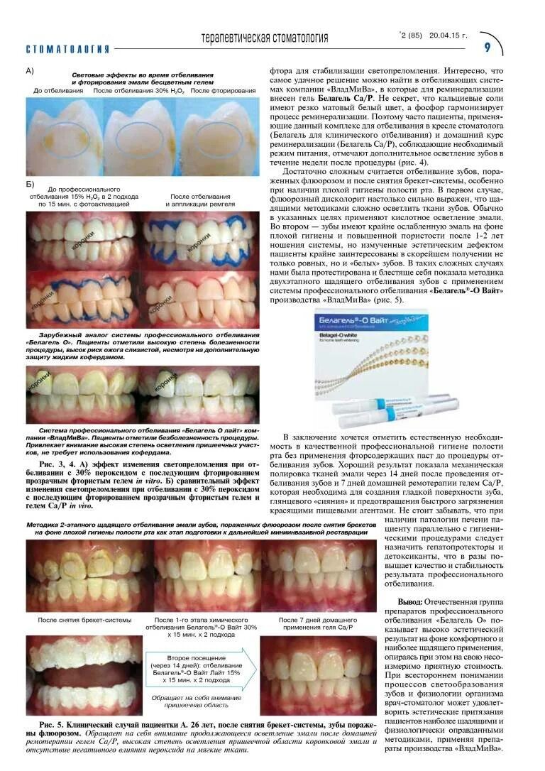 Прикусывать марлевый тампон. Через сколько можно пить после стоматолога. Памятка при отбеливании зубов. Памятка после удаления зуба для пациента. Через сколько можно пить после стоматолога.