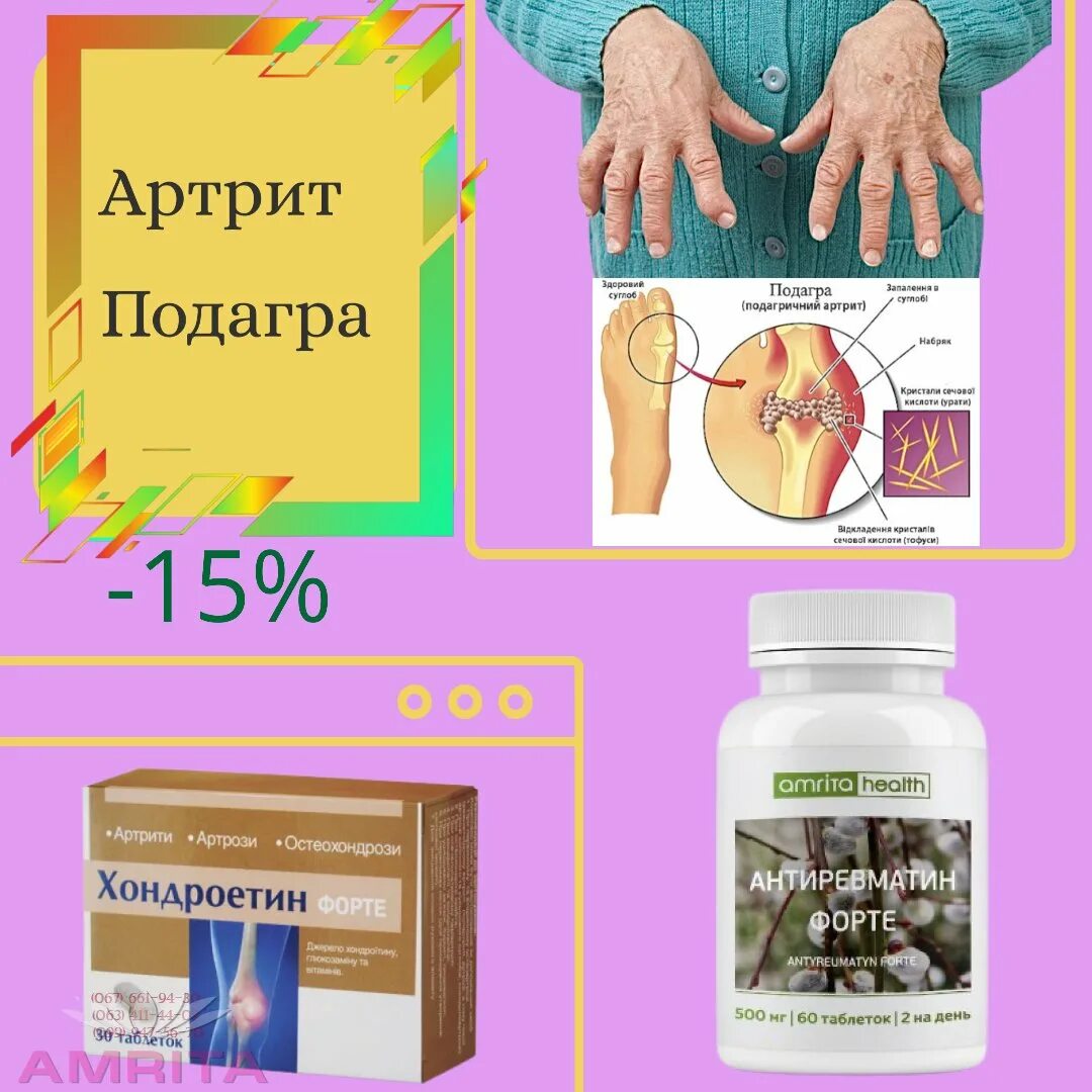 Лекарственное лечение подагры. Препараты для терапии подагры. таблетки от подагрического артрита. мазь от подагрического артрита.