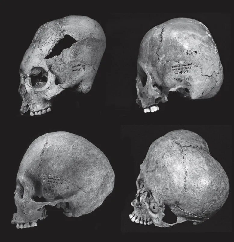 Варианты формы черепа. Деформация черепа Гунны. Гунны удлиненные черепа. Форма черепа. Форма человеческого черепа.