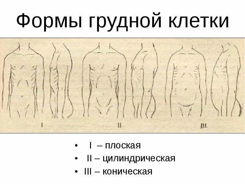 Конусовидная форма грудной клетки. Коническая форма грудной. Коническая форма грудной клетки. Форма грудной клетки у астеников. Форма грудной клетки у детей 2 года в норме.