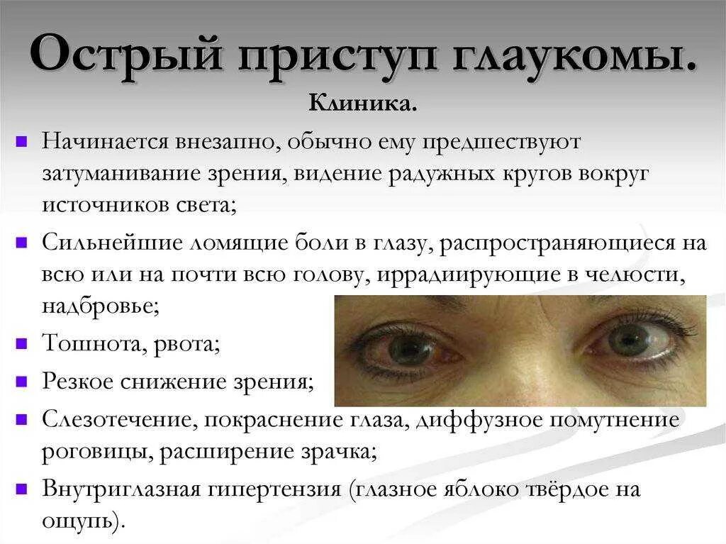 Причины глаукомы глаза. Острый приступ глаукомы клиника. Симптомы острого приступа закрытоугольной глаукомы. Острый приступ закрытоугольной глаукомы клиника. Отстрвй присьуп гдаукоиаю.