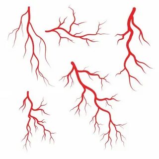 Devils veins