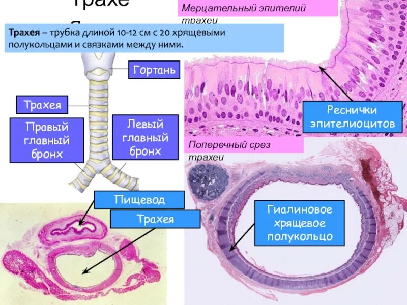 Трахея относительно пищевода. Мерцательный эпителий бронхов гистология. Строение стенки трахеи. Строение эпителия трахеи. Строение слизистой трахеи.