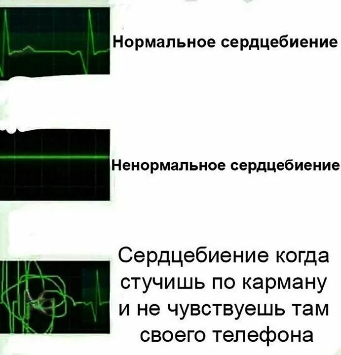 Почему не бьется вин. Ненормальное сердцебиение. Шутки про сердцебиение. Когда бросил сцепление при бате. Сердцебиение Мем.