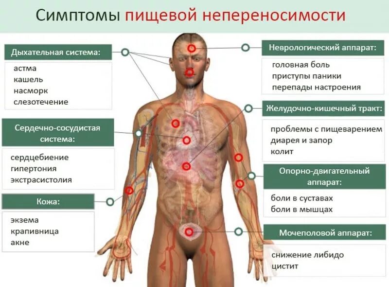 Аллергия признаки и симптомы. Пищевая непереносимость симптомы. проявление пищевой аллергии. пищевая аллергия симптомы.
