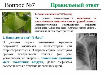 Эмфизема тканей