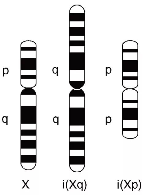 Изохромосома длинного плеча х-хромосомы. Робертсоновская транслокация кариотип. Изохромосома 12p. Транслокация 5 хромосомы.