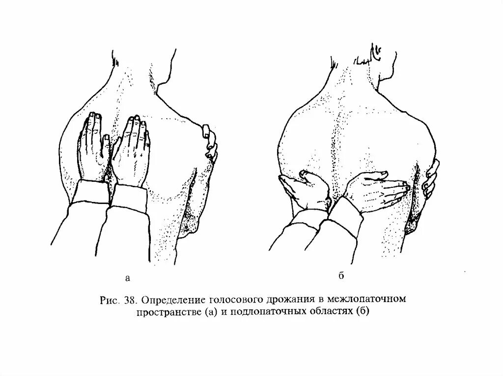 Усиленное голосовое дрожание. Методика проведения голосового дрожания. Голосовое дрожание пальпация. Метод определения голосового дрожания. Методика оценки голосового дрожания.