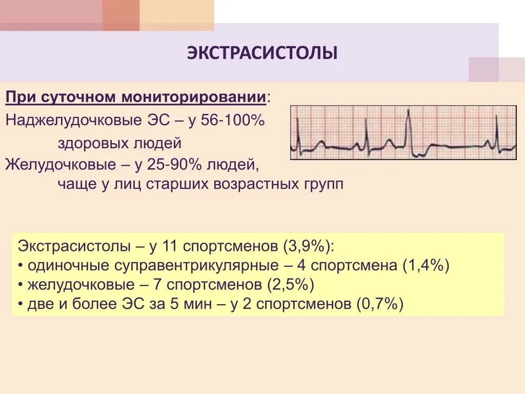 Сколько экстрасистол норма