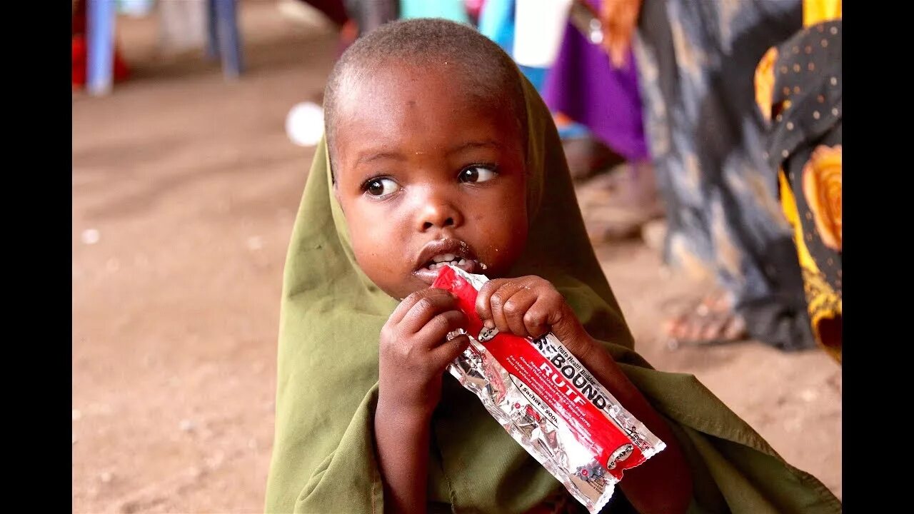 Голодный малыш. Голодные индийские дети. Голодные дети Сомали в Африке.