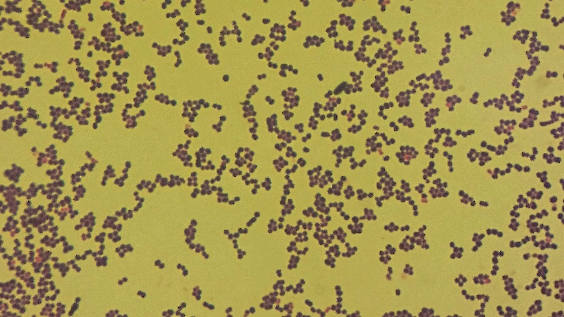 Anaerococcus spp. Aerococcus urinae. бруцелла микроскопия. aerococcus spp морфология.