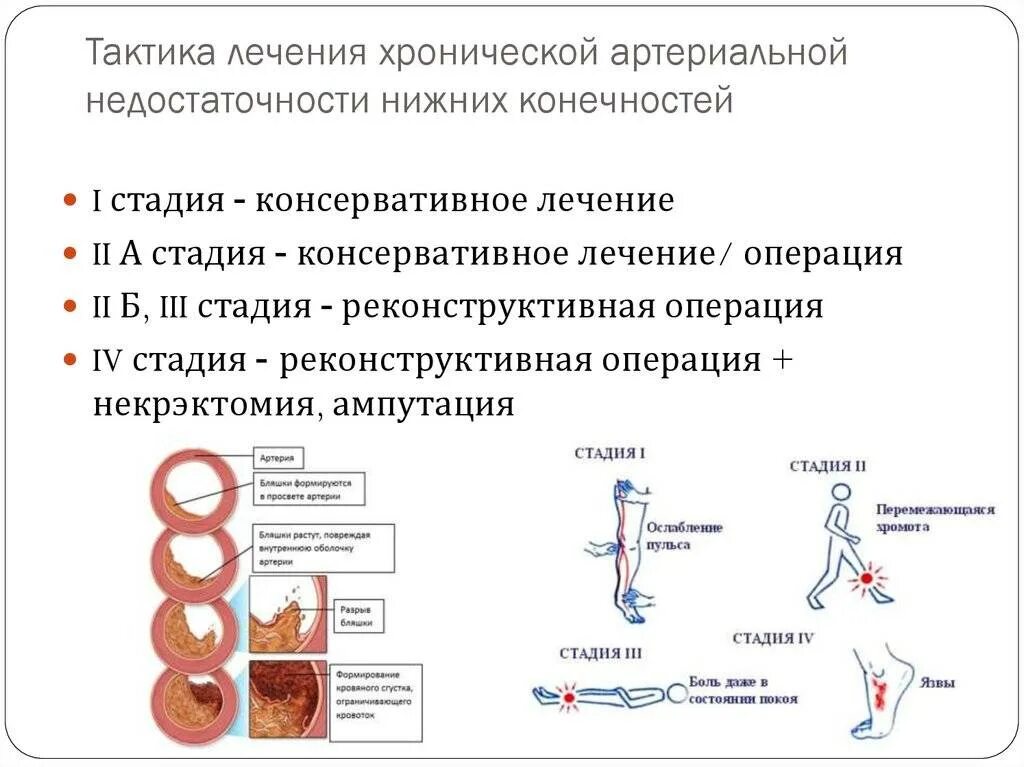 Ишемия нижних конечностей лечение. Хроническая артериальная ишемия нижних конечностей классификация. Хроническая артериальная ишемия Нижний конечностей патогенез. Хроническая артериальная недостаточность классификация. Патогенез артериальной недостаточности нижних конечностей.