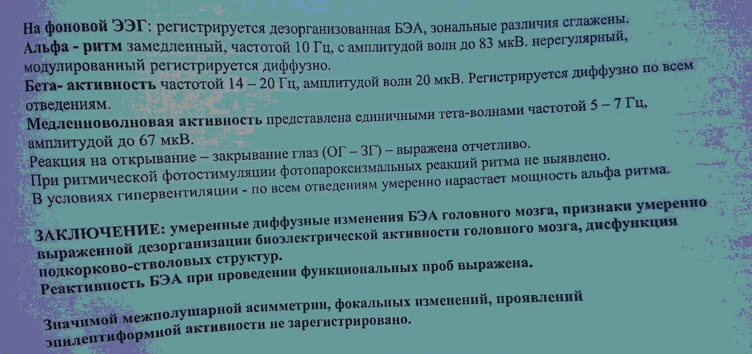 Активность ээг у ребенка что это. Расшифровка показателей электроэнцефалограммы ЭЭГ головного мозга. Электроэнцефалография заключение норма у ребёнка. ЭЭГ головного мозга заключение. ЭЭГ головного мозга нормальные показатели у ребенка.