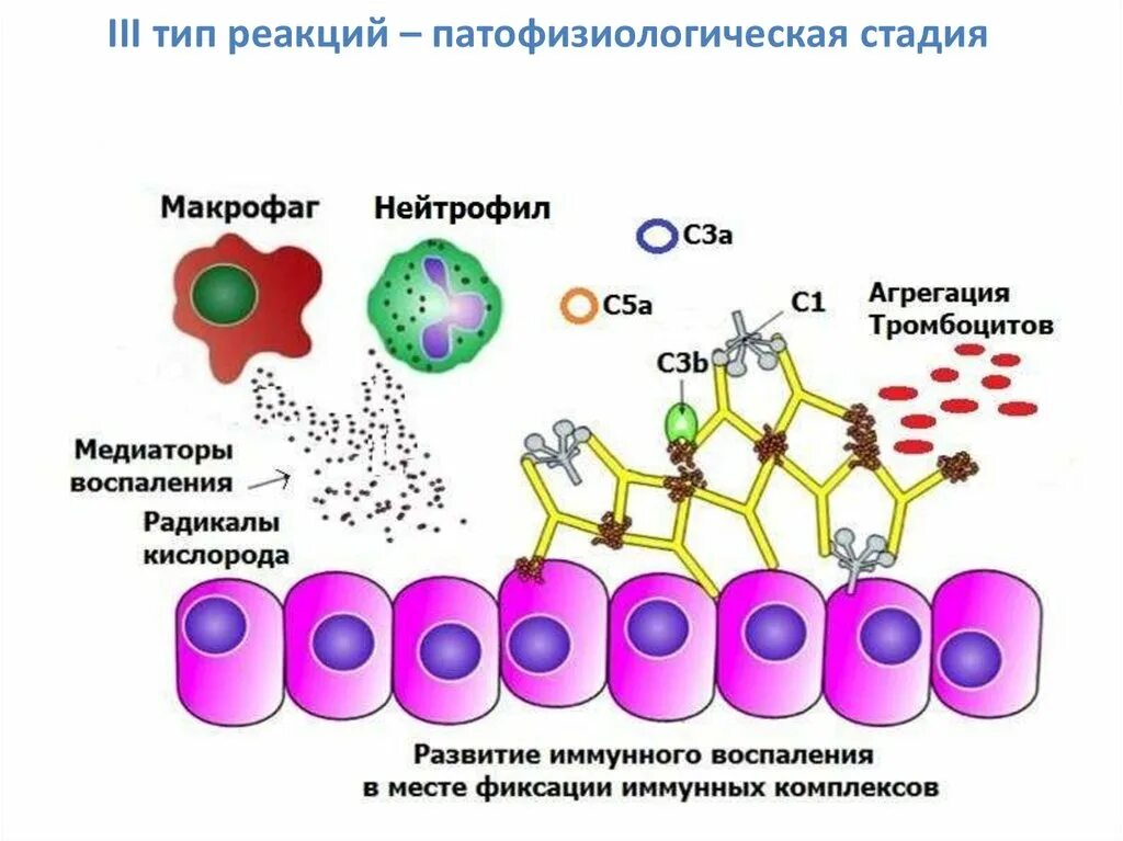 В первой стадии реакции. Третий Тип аллергической реакции патофизиология. Схема аллергической реакции 3 типа. Аллергическая реакция 3 типа патофизиология. Патогенез аллергических реакций 3 типа.