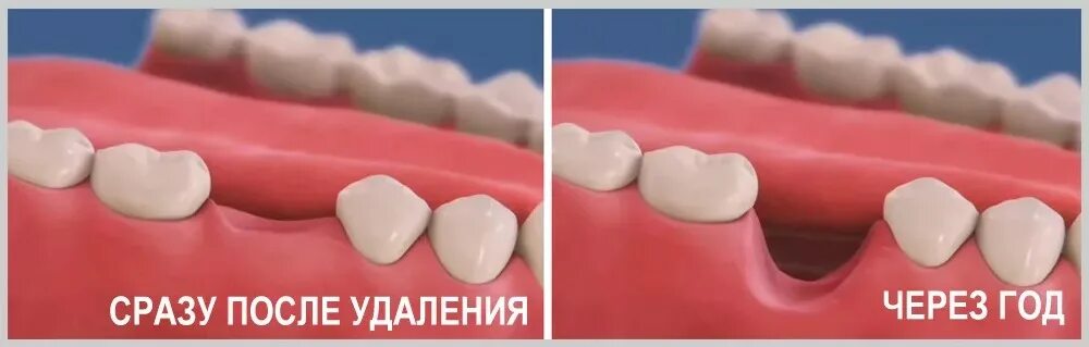 Как выглядит шов после имплантации Маммопластика: шрамы, рубцы и швы как убрать после операции