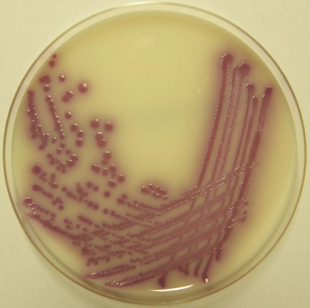 Бактерия сальмонелла Тифи. Salmonella typhi микробиология. Salmonella SPP, сальмонелла.. Salmonella typhi возбудитель брюшного тифа. Сальмонеллез б