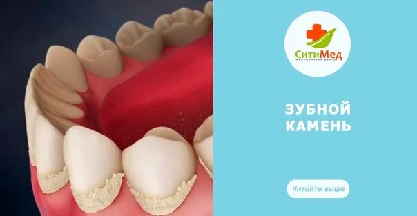 Обработка натурального камня. Камень убрать той. Камень убрать той. Камень убрать той. Камень убрать той.