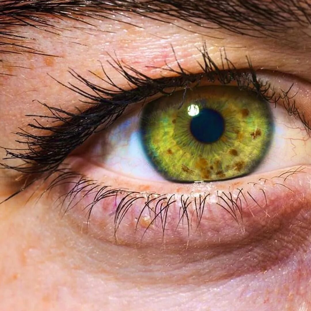 Разнообразие глаз. Гетерохромия Радужки глаз. Центральная гетерохромия зрачок. Центральная гетерохромия хамелеон. Центральная гетерохромия зеленый Карий.