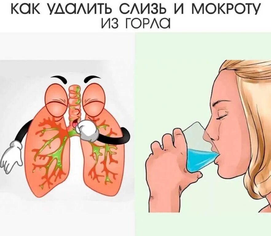 Что делать если мокрота стоит. Что делать если мокрота стоит