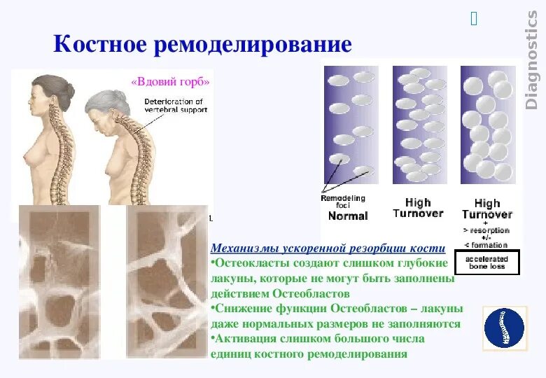 Маркер костной резорбции. Маркеры резорбции костной ткани. Ремоделирования костной ткани биохимия. Костный ткань нормальная и остеопороз. Фазы ремоделирования костной ткани.