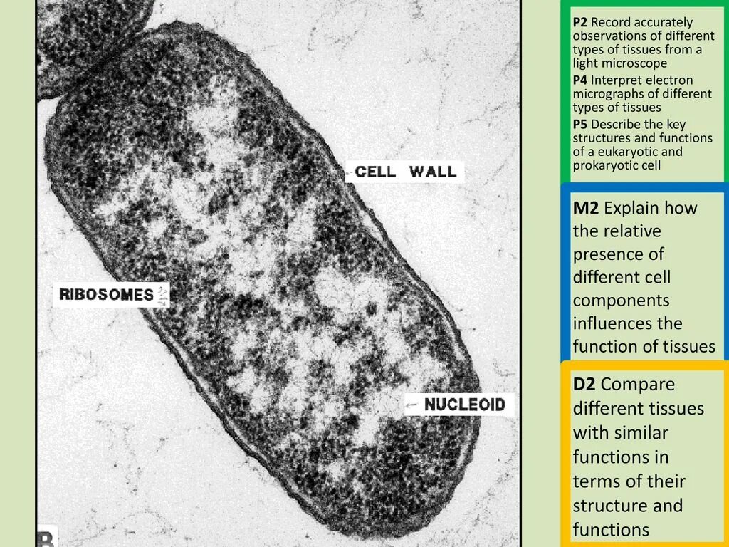Электронная микрофотография клетки кишечной палочки. Электронная микрофотография кишечной палочки. Бактерия кишечной палочки escherichia coli. Кишечная палочка escherichia coli. Прокариоты бактерии и археи.