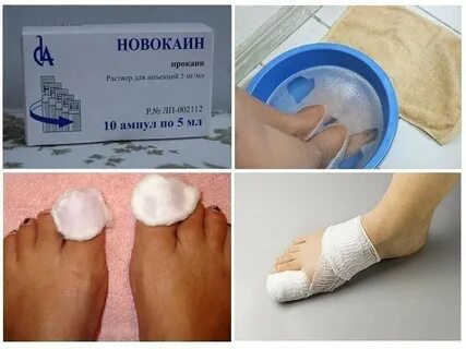 Димексид от грибка ног
