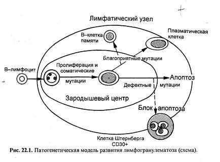 Острая лимфатическая лихорадка