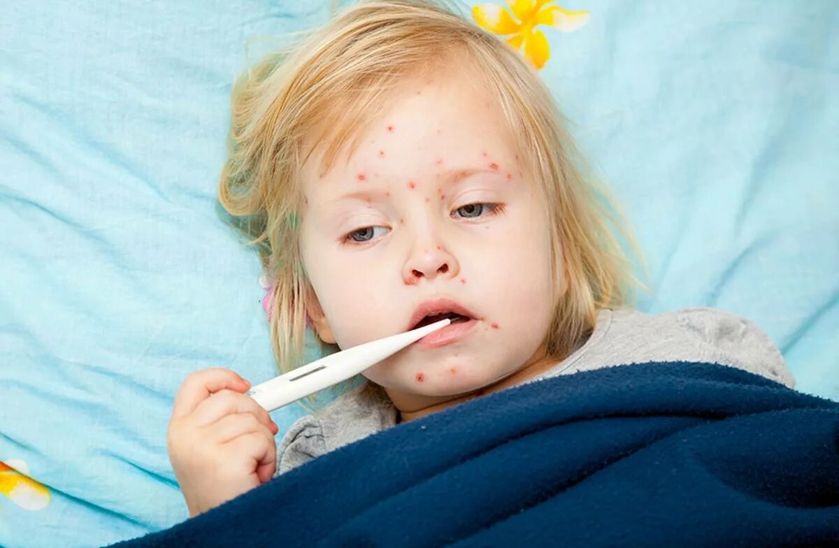 Корь это респираторная вирусная инфекция. Кор вирус. Структура вириона вируса кори. Корь вирус патогенез. Кор вирус.