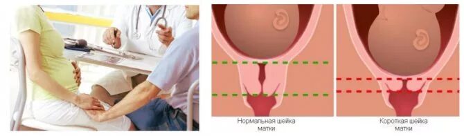 Боль Внутри Влагалища При Сексе