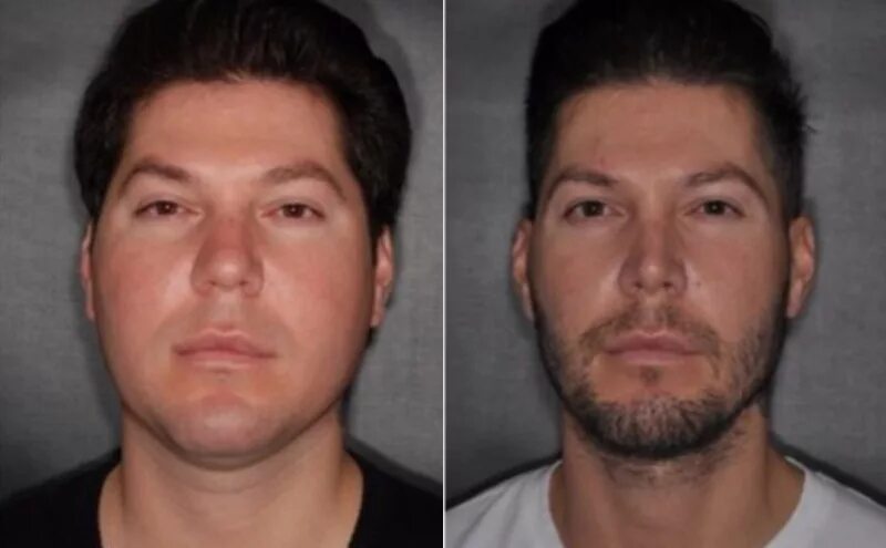 как уменьшить лицо мужчине. мужской макияж естественный. как уменьшить лицо мужчине. отвисший подбородок у мужчин. операция на скулы мужчины.