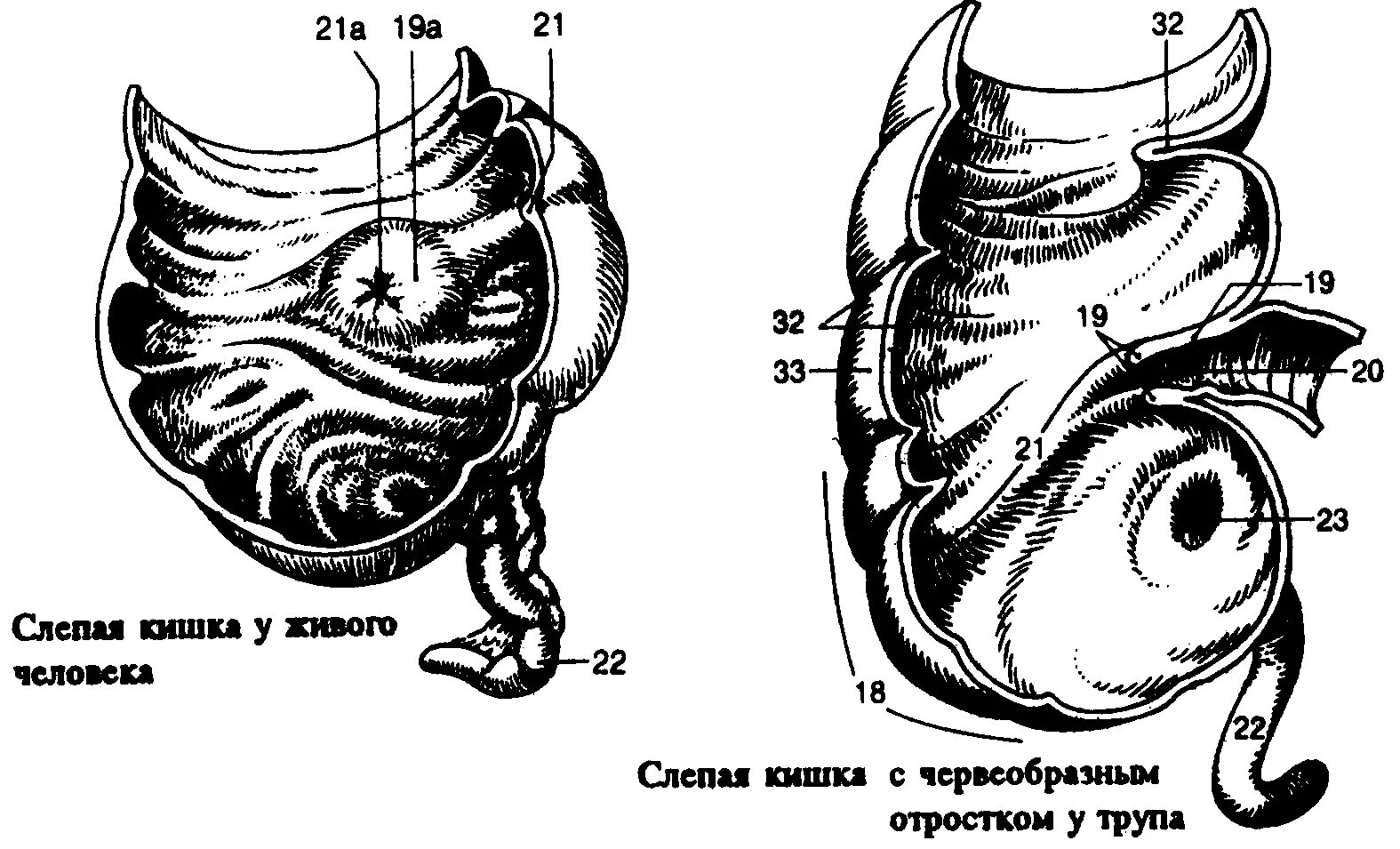 Слепая и подвздошная кишка. Толстый кишечник илеоцекальный клапан. Слепая кишка илеоцекальный клапан. Илеоцекальный клапан топография. Слепая кишка илеоцекальное отверстие.