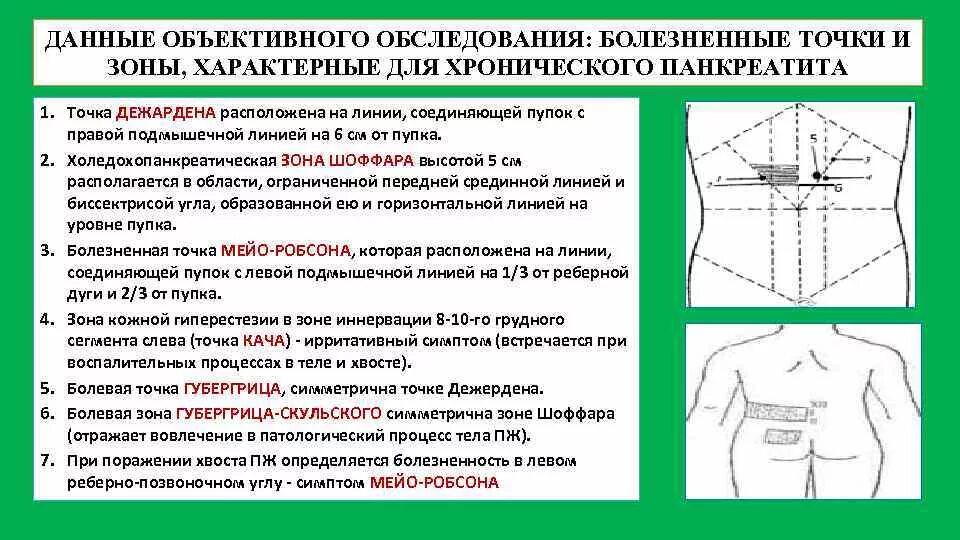 Пальпация при остром животе. Точка Дежардена и зона Шоффара точка Мейо-Робсона. Симптомы панкреатита Мейо Робсона. Точка Губергрица и Мейо-Робсона. Острый панкреатит симптом Мейо Робсона.