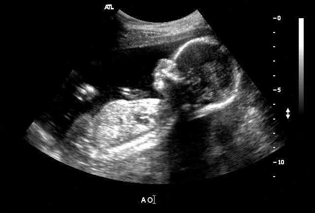 Малыш на 22 неделе беременности УЗИ. Плод на 22 неделе беременности фото УЗИ. УЗИ ребенка на 31 неделе беременности. 19 недель назад