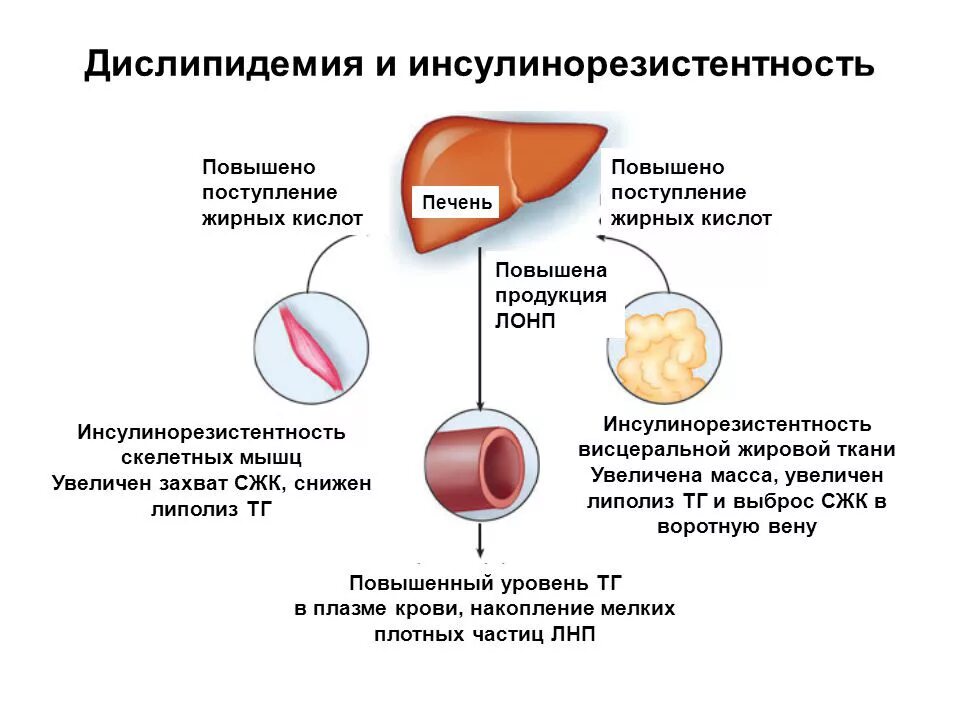 Атеросклероз механизмы развития дислипидемии. Инсулинорезистентность и дислипидемия. Синдром дислипидемия. Дислипидемия что это такое как лечить.